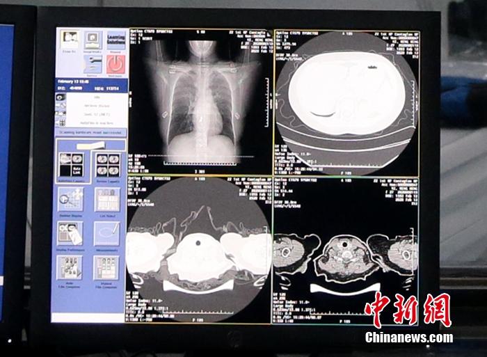 无极4总代理注册